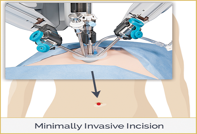 MINIMAL INVASIVE PROCEDURS